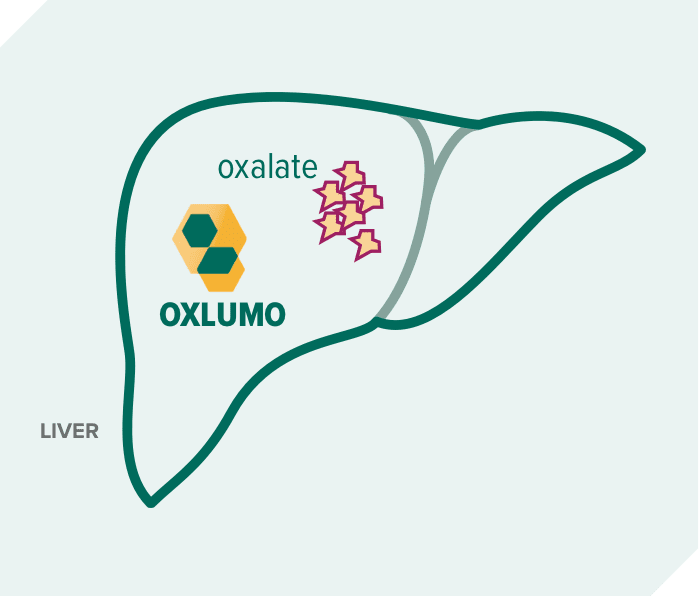 Graphic of OXLUMO® (lumasiran) targeting oxalate in the liver