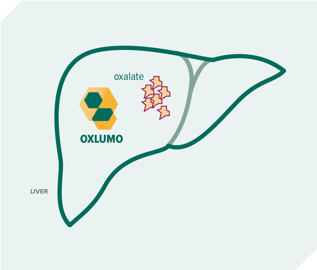 Graphic of OXLUMO® (lumasiran) targeting oxalate in the liver